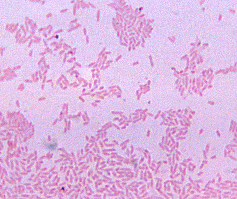<p><span><span>Your Gram stain is complete and correct. Which of the following statements would apply to the image you see?</span></span><br></p>