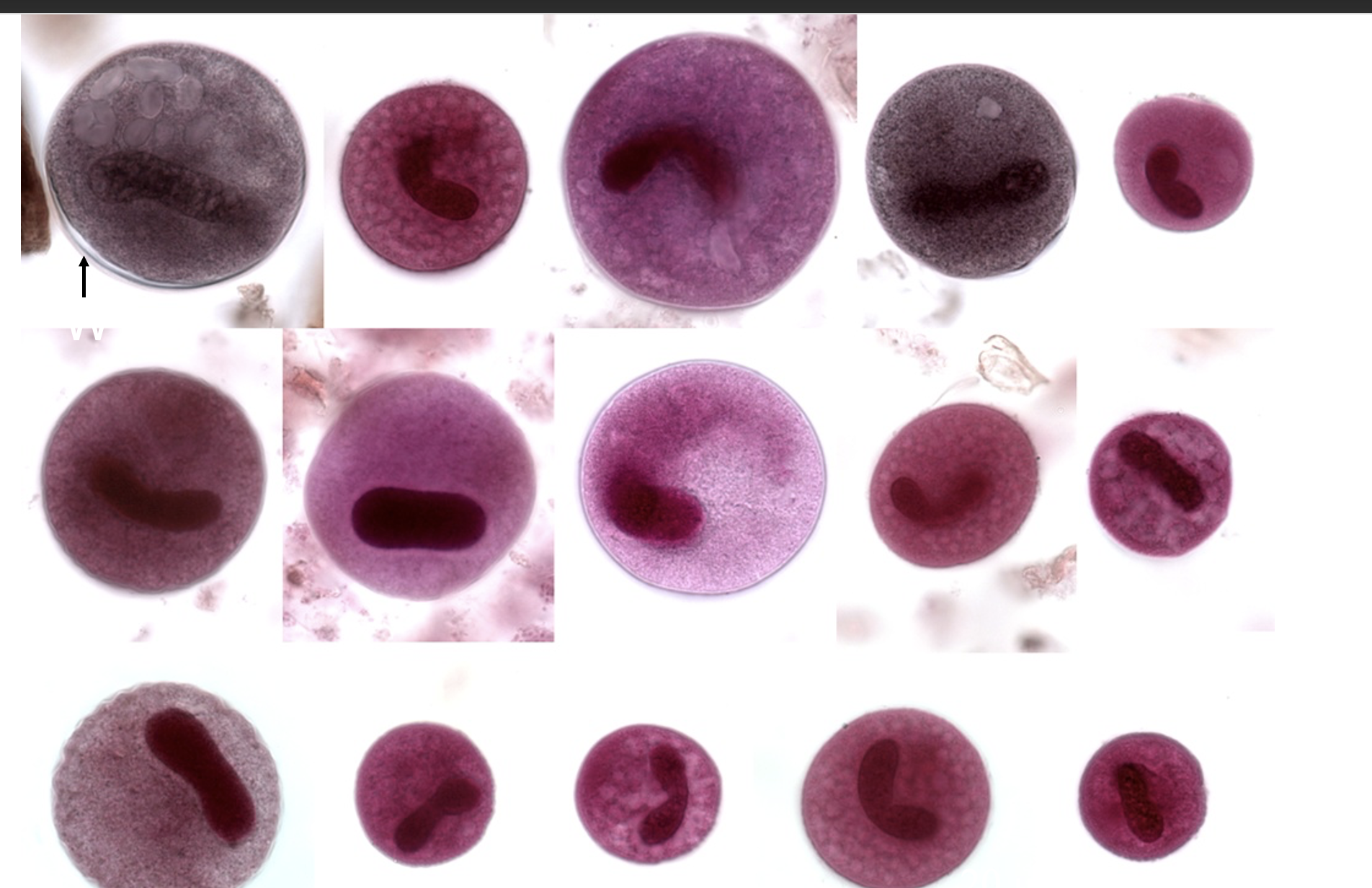 <p>Name: Balantidium coli</p><p class="p1">Stage: trophozoite</p><p class="p1"><strong>*</strong>macronucleus (<span> </span>kidney-shaped - bean-shaped)</p><p class="p1">*micronucleus (Sits next to macronucleus, faint, <span> </span>harder to distinguish)</p>