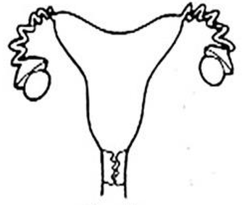 <p>Which uterine classification is this?</p>