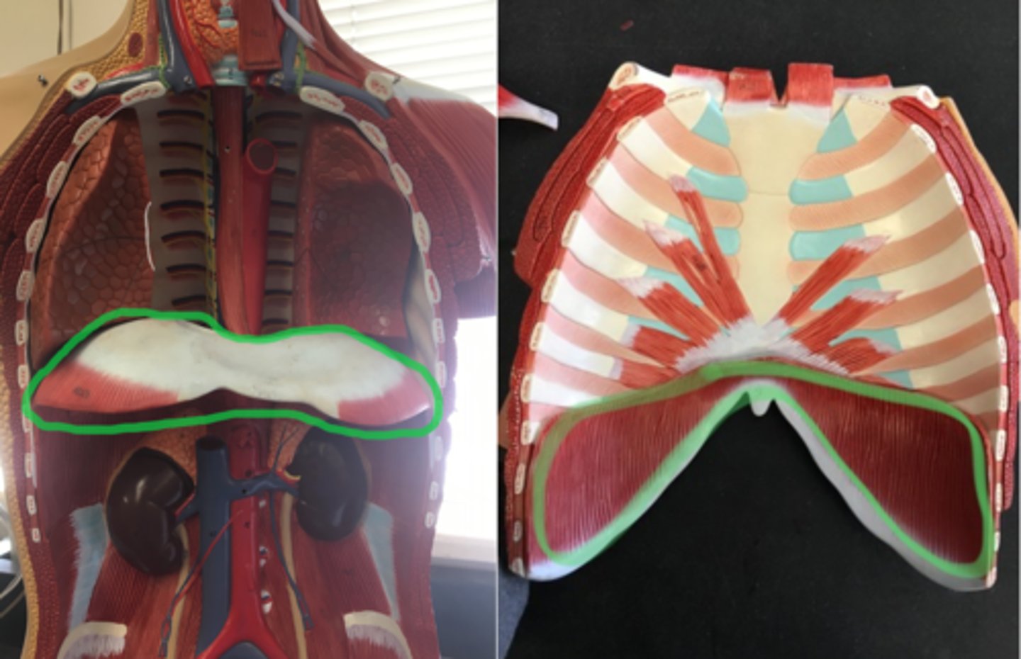 <p>Under chest cavity, on model all of red portion on the bottom sheet muscle, vertical striations.</p>