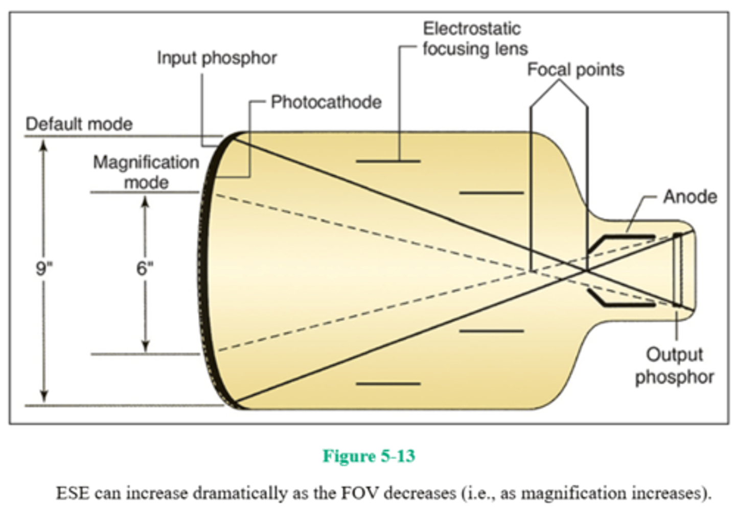<p>4. (A, C, and D)</p><p>Image-intensifier output phosphor/screen diameters of 5-12 inches are available. Although smaller diameter input screens improve resolution, they do not permit a large fluoroscopic FOV.</p><p>Dual- and triple-field image intensifiers are available that permit magnified viewing of fluoroscopic images. To achieve magnification, the voltage to the focusing lenses is increased and a smaller portion of the input phosphor is used, thereby resulting in a smaller FOV (and subsequent loss of brightness). The milliamperage is automatically increased to compensate for the loss in brightness when the image intensifier is switched to the magnification mode. When voltage applied to the focusing lenses increases, the focal point is further away from the output phosphor, and the output image is magnified.</p><p>ESE can increase dramatically as the FOV decreases (i.e., as magnification increases).</p><p>As FOV decreases, magnification of the output screen image increases, there is less noise because increased milliamperage provides a greater number of x-ray photons, and contrast and resolution improve. The focal point in the magnification mode is further away from the output phosphor (as a result of increased voltage applying to the focusing lenses) and therefore the output images magnified.</p>