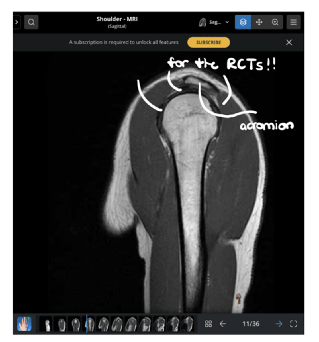<p>What is the missing word in this image: "________ for the RCTs!!"</p>