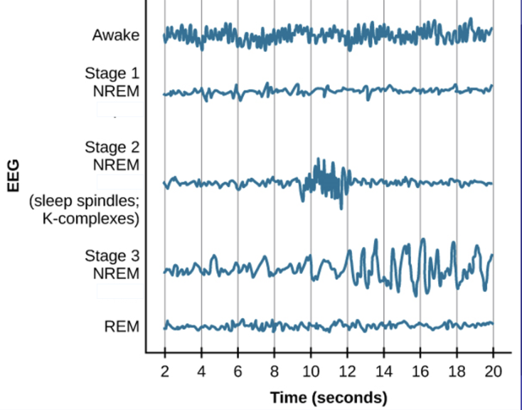 <p>an electroencephalogram</p>