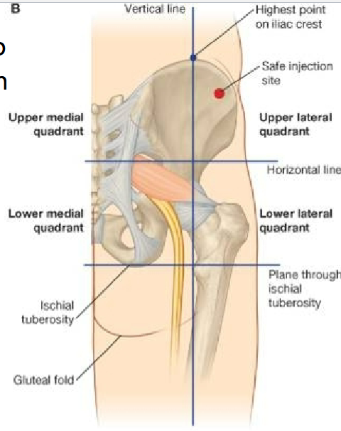 <ul><li><p><span>Superior gluteal nerve</span></p></li><li><p><span>Inferior gluteal nerve</span></p></li><li><p><span>Sciatic nerve</span></p></li></ul><p></p><p>Safe =&nbsp;<span>Upper lateral quadrant</span></p><p></p>