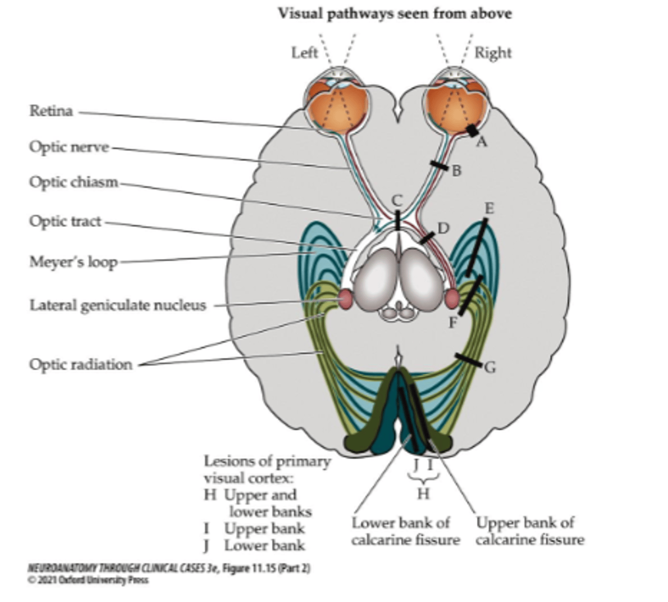 <p>Optic nerve</p>