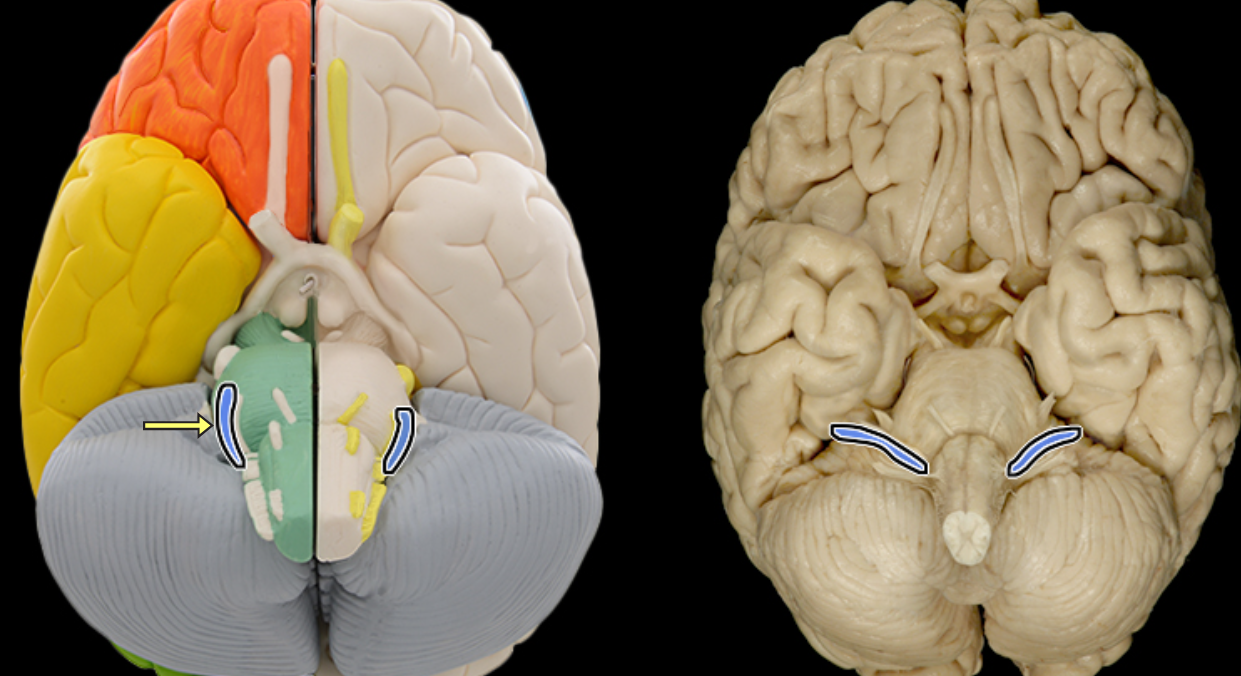 <p>Vestibulocochlear n. CN VIII</p>