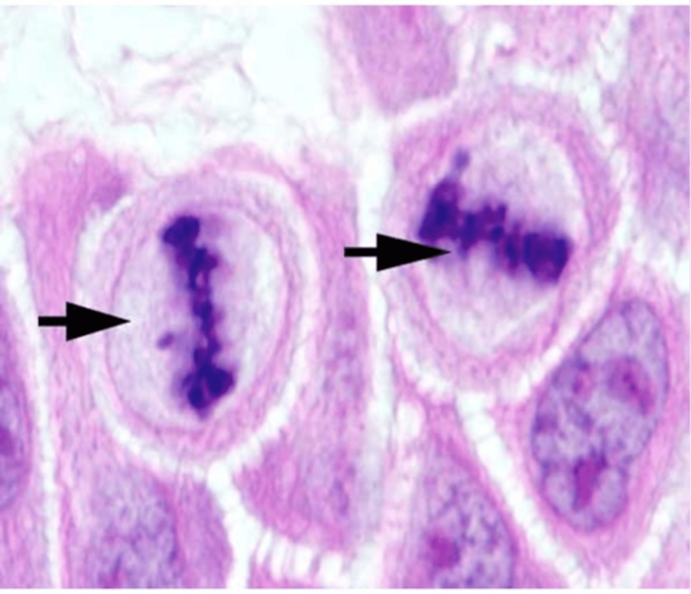 <p>Chromosomes align at the cell's equator.</p>