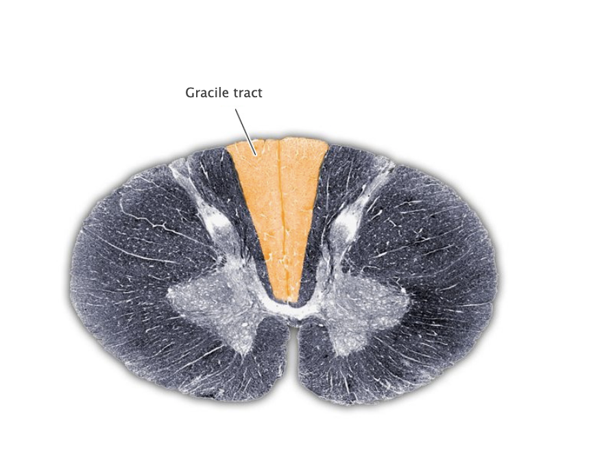 <p>Gracile tract</p>