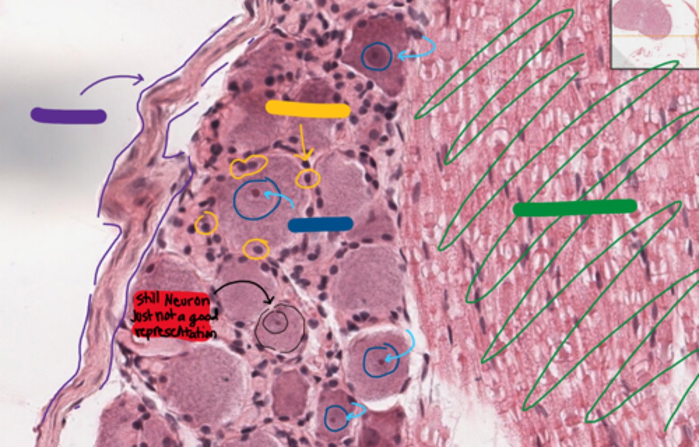 <p>the neuron indicated in red.</p><p>Why is it not a good representation of a dorsal root ganglion neuron?</p>