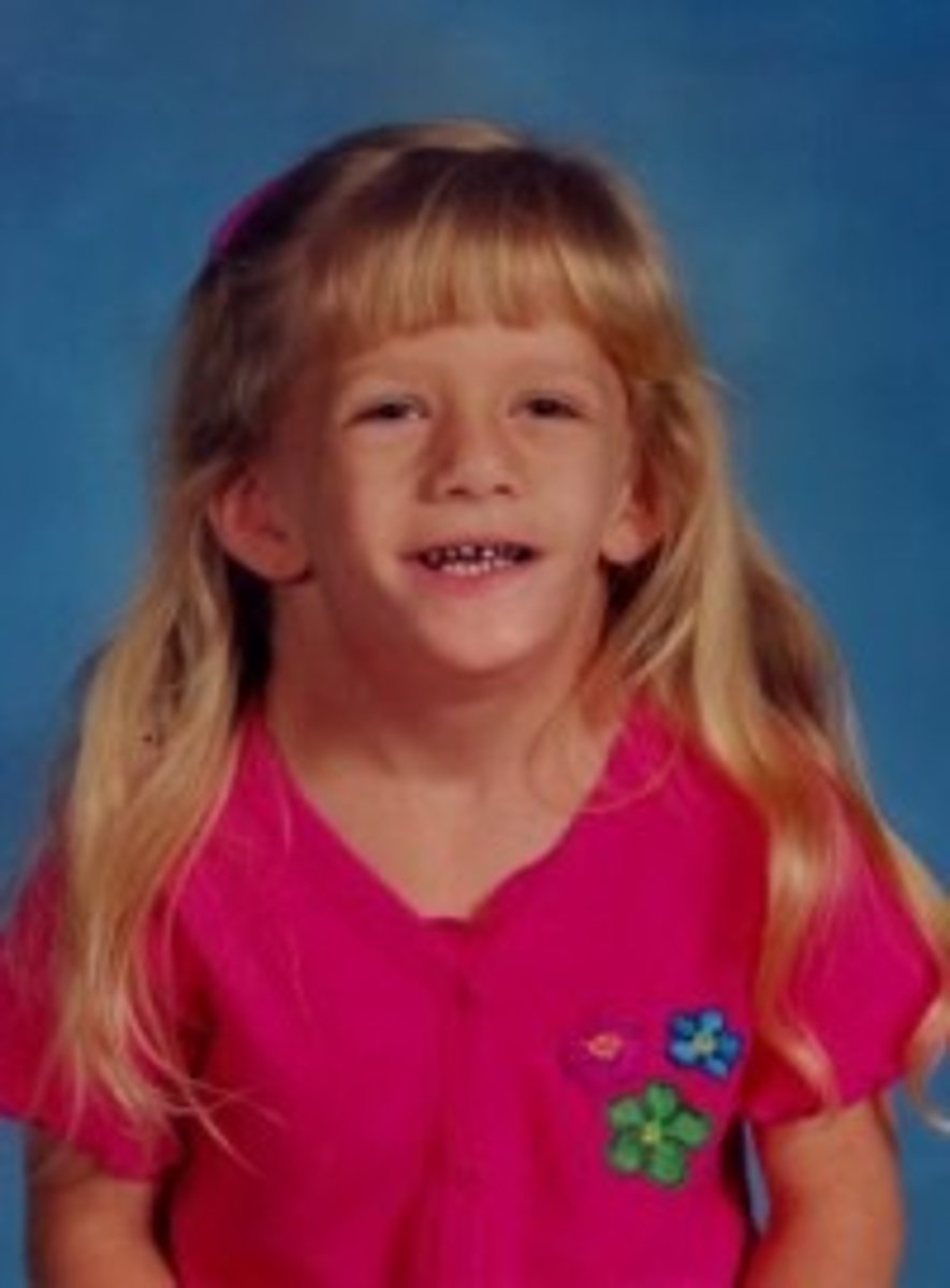 <p>Females with a missing or deformed X chromosome</p><p>No menstruation or fertility, cardiac deficits, narrow maxilla and palate, micrognathia, low-set, elongated, cup-shaped ears, thick earlobes, high arched palate, sometimes cleft palate, R hemisphere dysfunction</p><p>Sensorineural HL in many cases (usually after 10th year), middle ear infections, conductive loss sometimes, language and artic disorders with HL, visual, spatial, and attentional problems</p>