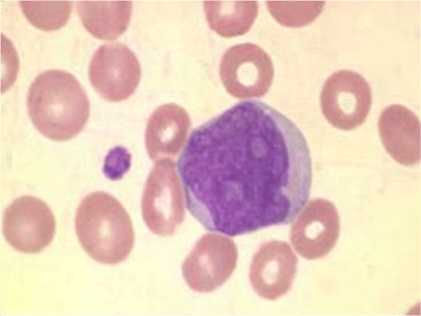 <p>Immature white blood cell (monocyte).</p><p>-prominent nucleoli</p>