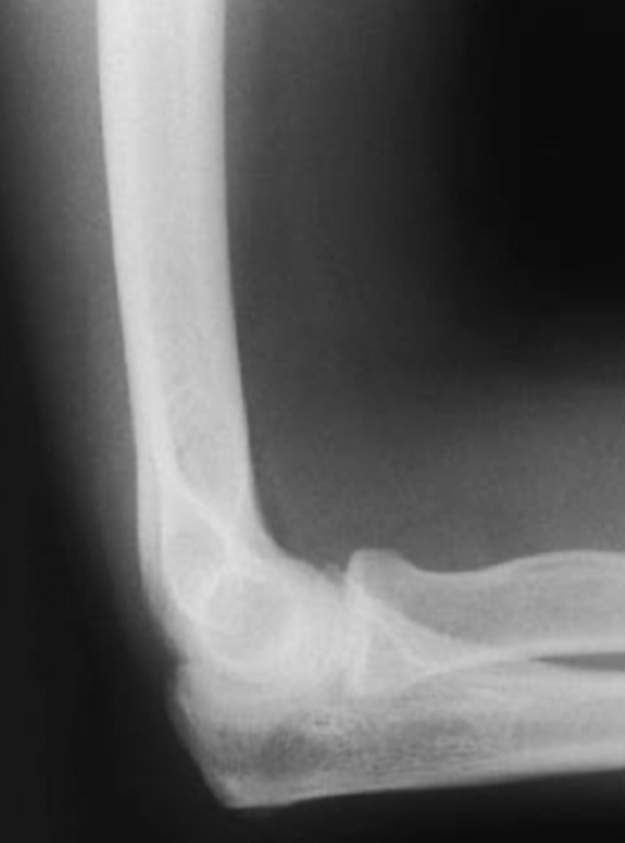 <p>What is the issue?</p>