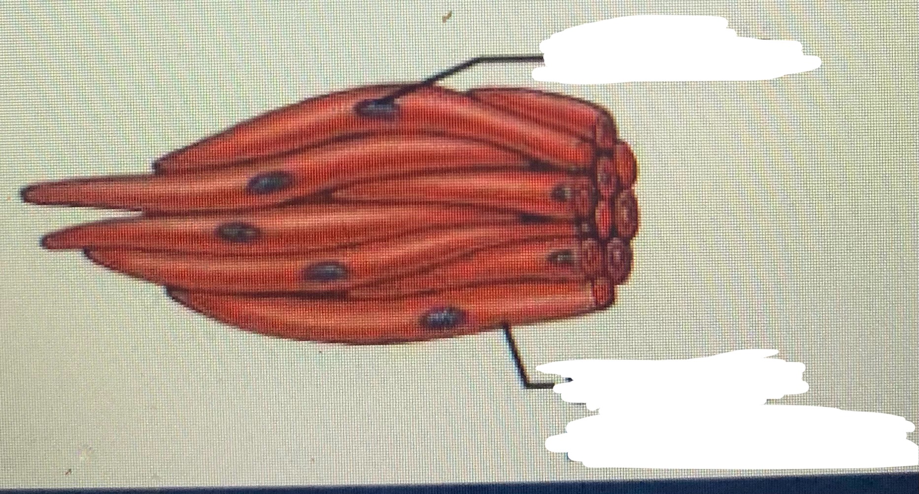 <p>Name the muscle </p>