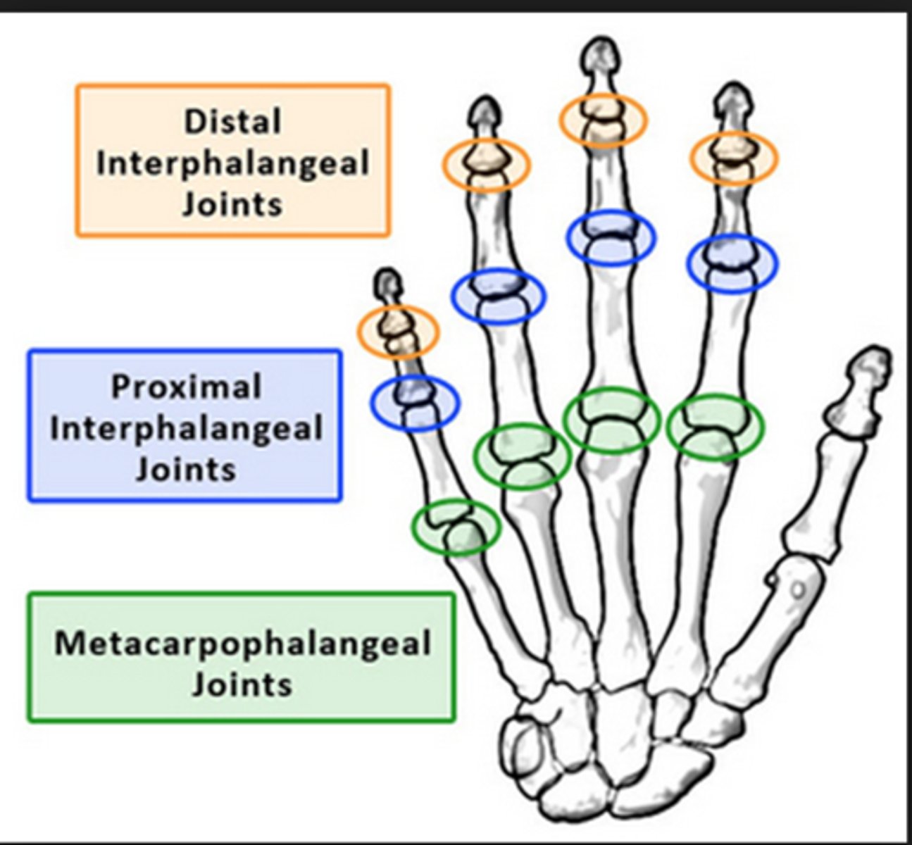 <p>1. Distal interphalangeal joint<br>2. Proximal interphalangeal joint<br>3. Carpometacarpal joint</p>