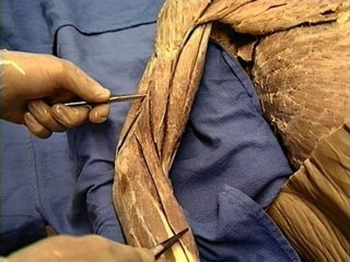 <p>Flexes elbow</p>