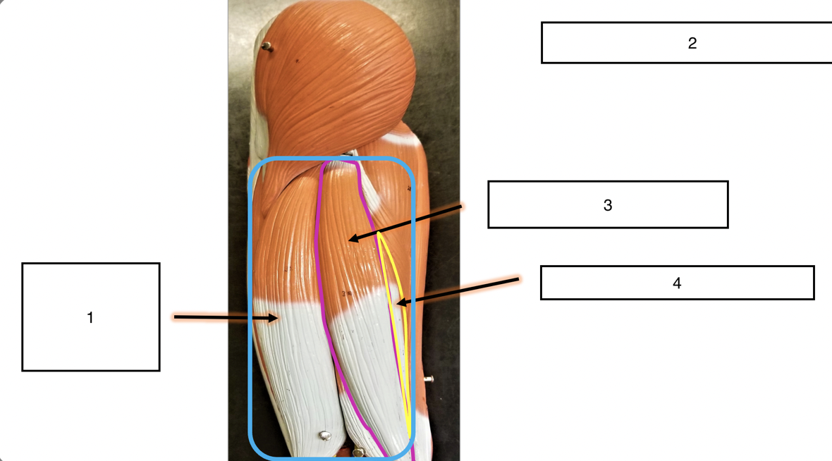 <p>name the groups of muscles (2)</p>