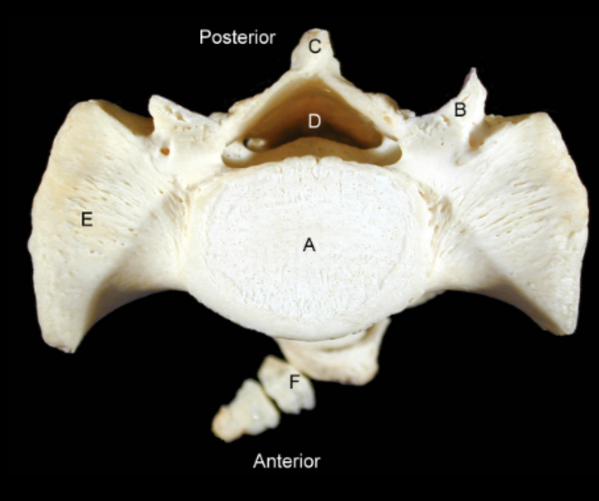 <p>Identify the structures of the Sacrum &amp; Coccyx - Superior View</p>