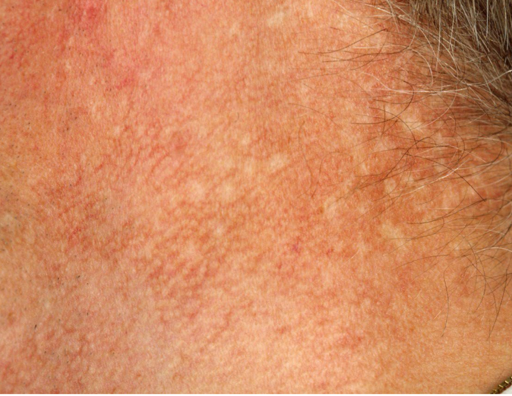 <p>what condition is depicted</p>