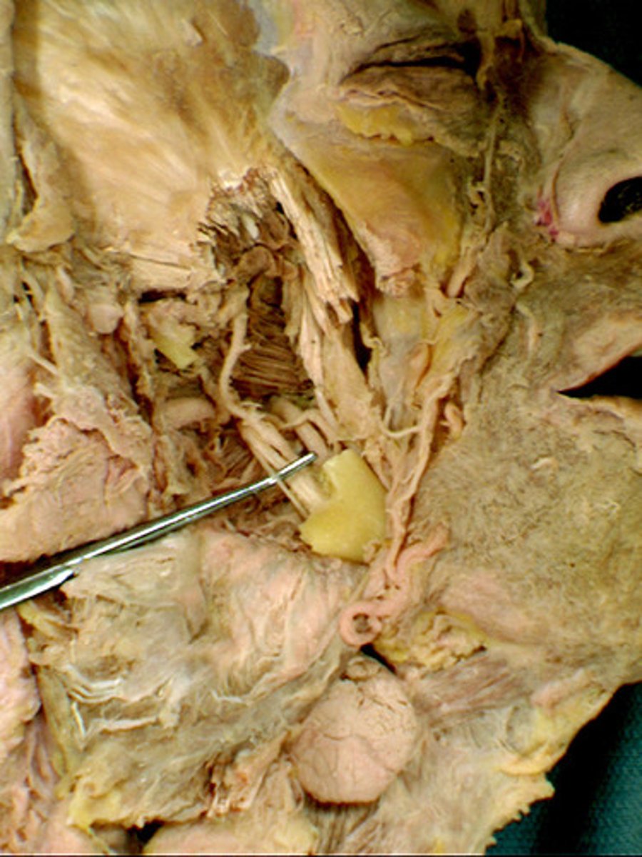 <p>supplies the mylohyoid and anterior belly of digastric muscles</p>