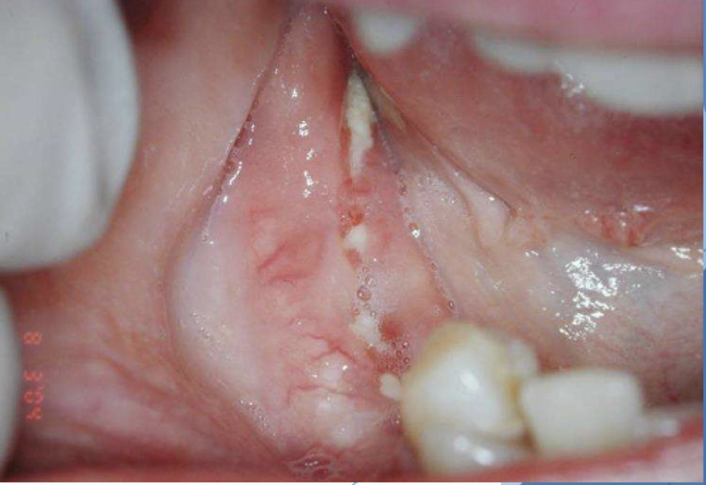 <p>what do you suspect?</p>