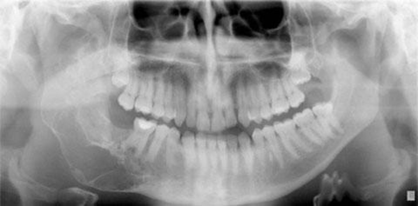 <p>chin tipped down too far</p>