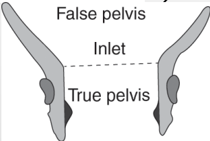 <p>What is being described?</p><p>-Rim of pelvic cavity, encircled by bone</p><p>-Where the bladder sits </p>