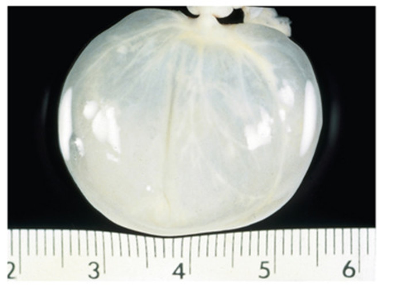 <p>This is metacestode stage called Cysticercus tenuicolis. The canine tapeworm is called</p>