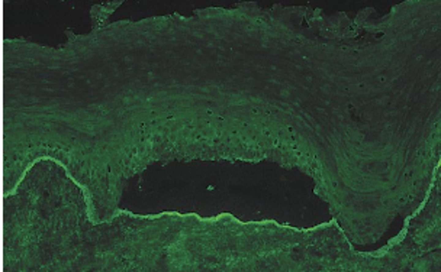 <p>Blistering in this disease is due to antibodies directed against component of ___? (picture showing histo slide with basement layer split)</p>