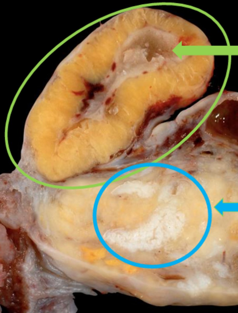 <p>the corpus luteum (top) regresses and becomes corpus albicans at the conclusion of _____</p>