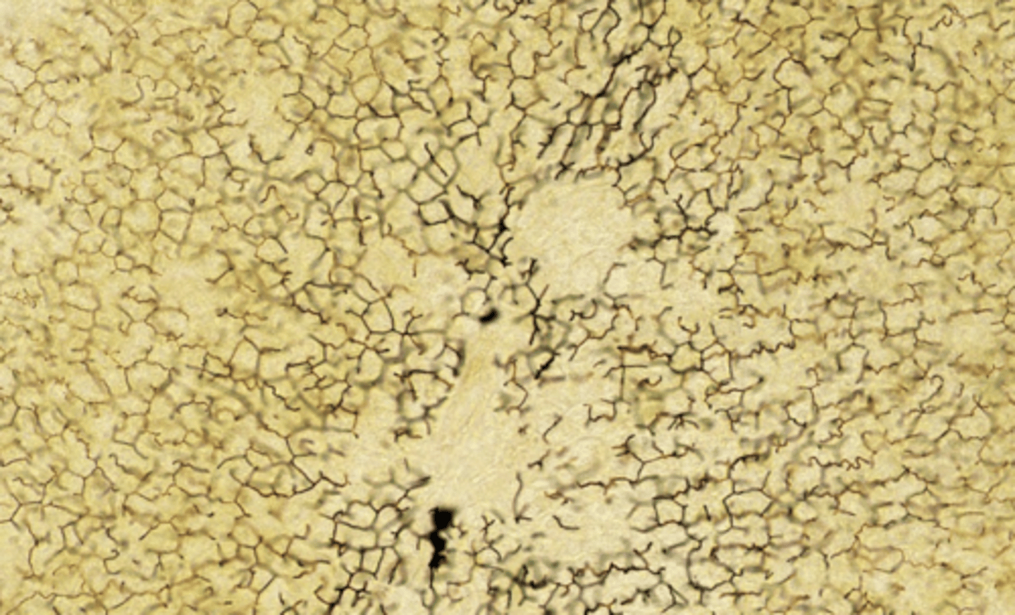 <p>Reticular fibers are made up of type III collagen and provide a supporting framework (stroma) for the liver's cellular components (ex. hepatocytes). </p><p>helping maintain the organ's structural integrity (SPECIALLY OF SINUSOIDAL SPACE).</p>