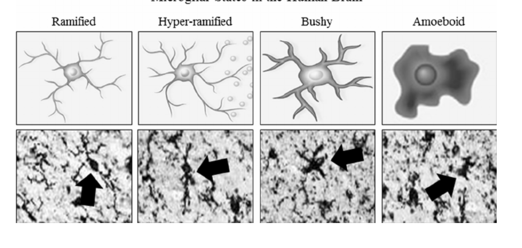 <p>Les microglies changent de forme en une forme arrondi amoeboid → microglie réactive.</p>