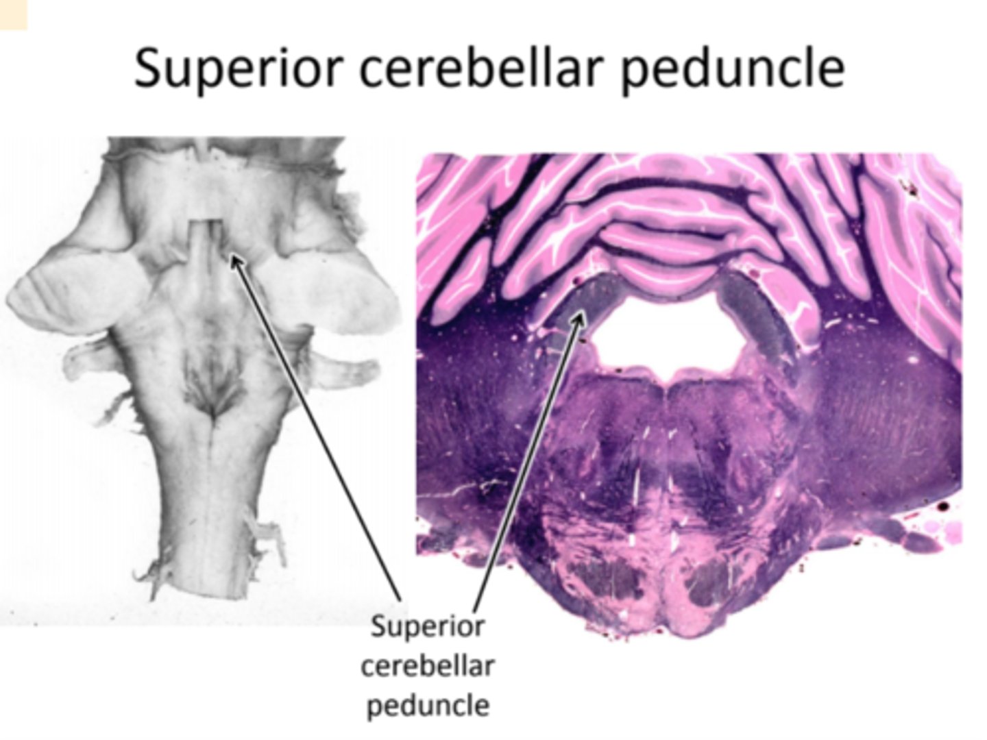 <p>- superior cerebellar peduncle is composed mostly of fibers originating in the cerebellum and projecting to the rostral midbrain (--Red nucleus) and the thalamus. These axons are involved in control of movement</p>