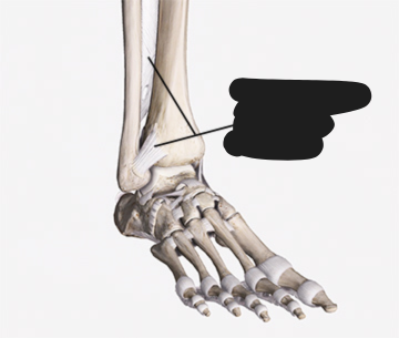 <p><span style="background-color: transparent;"><span>Found between some long bones such as the tibia and fibula.</span></span></p>