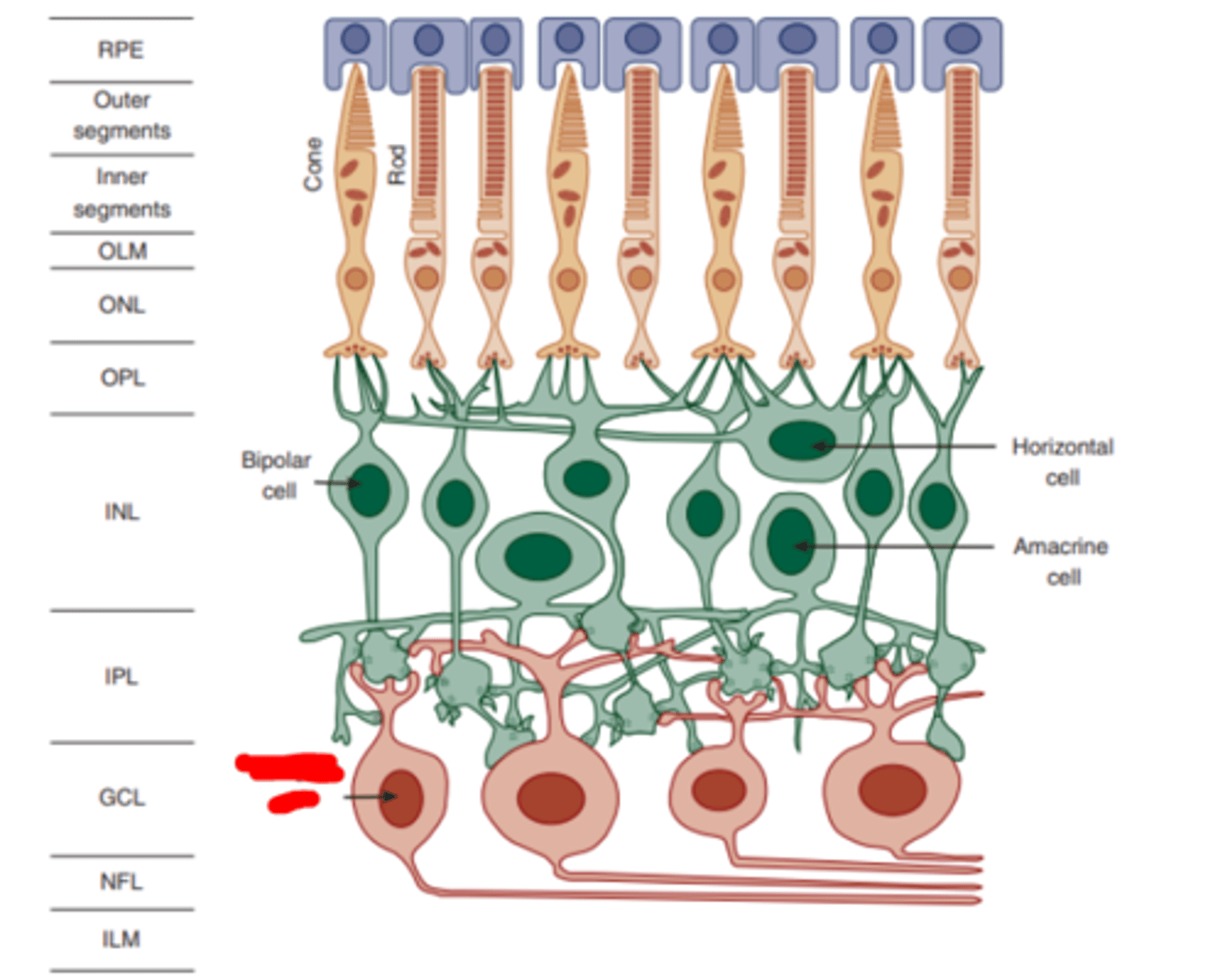 <p>cells who receive input from bipolar and amacrine cells and whose long axons leave the eye to form the optic nerve and synapse in the LGN. Their fundamental role is in edge detection. THE FIRST RETINAL CELLS TO GENERATE ACTION POTENTIALS.</p>