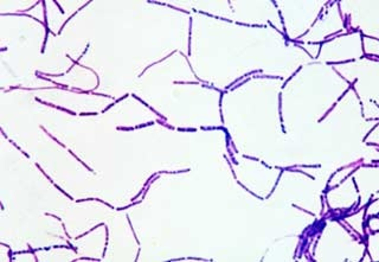 <p></p><p><strong>Purple rods (Gram-positive bacillus, often in long chains).</strong></p><p>Type: Bacteria;</p><p>Disease: Anthrax (skin sores, lung infection, or GI infection);</p><p>Diagnosis: Lab culture, PCR, chest X-ray (for inhaled anthrax);</p><p>Treatment/Prevention: vaccine </p><p>Spread/Unique: Spore-forming (can survive decades in soil); found in livestock; potential bioterror agent.</p>