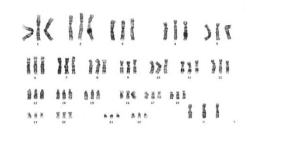 <p>this photo describes what kind of ploidy</p>
