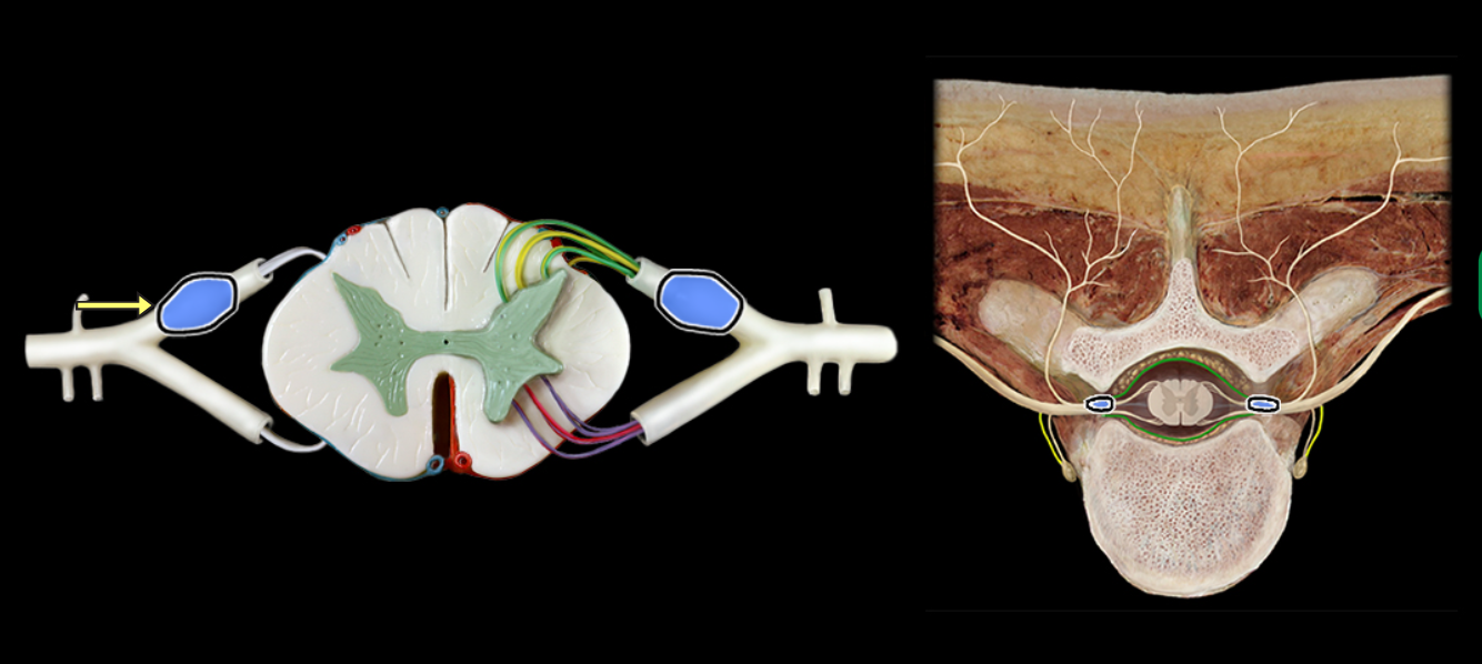 <p>Dorsal root ganglion</p>