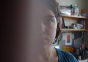 <p>Which neurologic deficit pathology is associated with this image? </p>