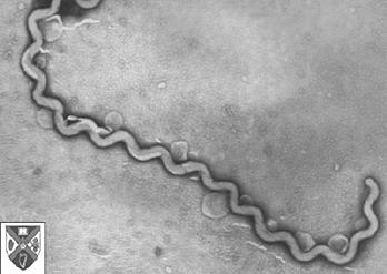 <p>long, spiral shaped</p>