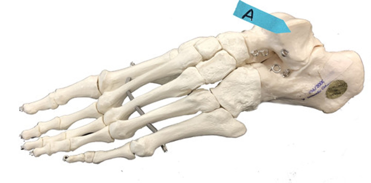 <p>Identify this specific bone.</p>