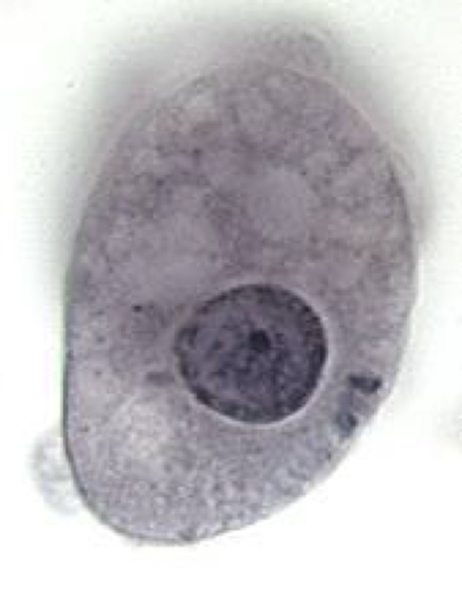 <p>Name the stage and species.</p><p>NOTE: Endosome eccentric and larger granules in the ring of peripheral chromatin. Also note how many more medium cytoplasmic vacuoles are present.</p>