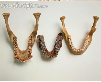 <ul><li><p>Reduction in size; canines no longer interlock</p></li><li><p>Upper canine no longer hones (sharpens) on 1st lower premolar</p></li><li><p>Dental arcade (tooth row) changes from U-shape to parabola (refer to diagram)</p></li><li><p>Enamel got thicker</p></li></ul><p></p>