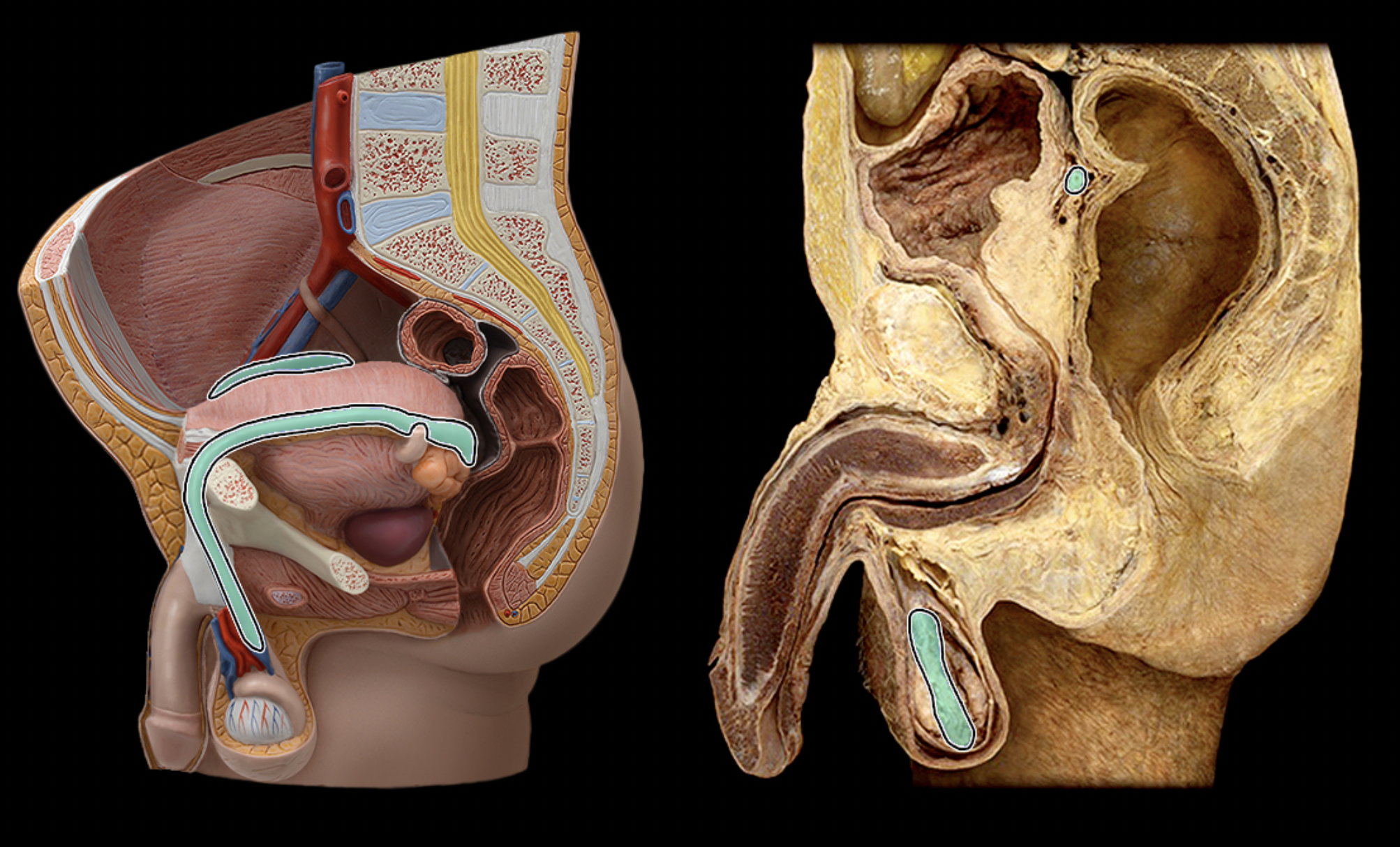<p>What structure is shown?</p>