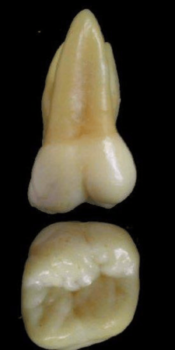 <p>what tooth is this &amp; why?</p>