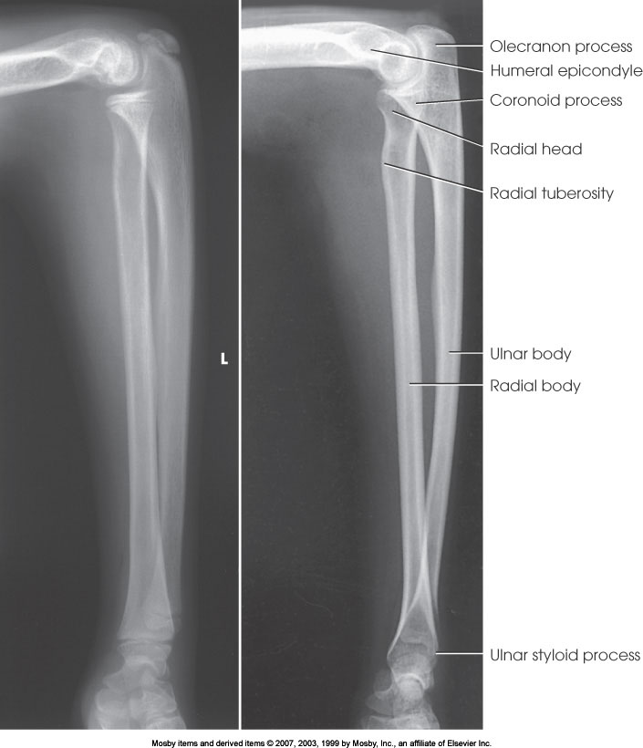 <p>What position is demonstrated?</p>