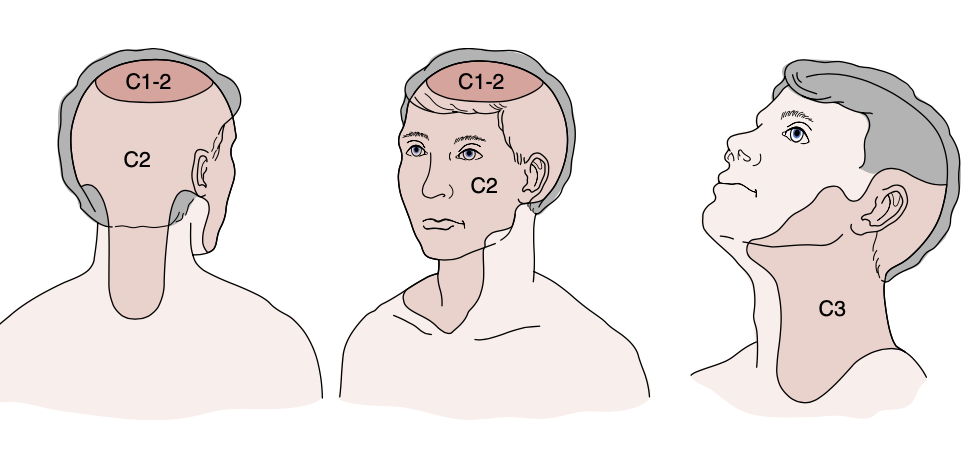 <p>Dermatomes of Head</p><p></p>