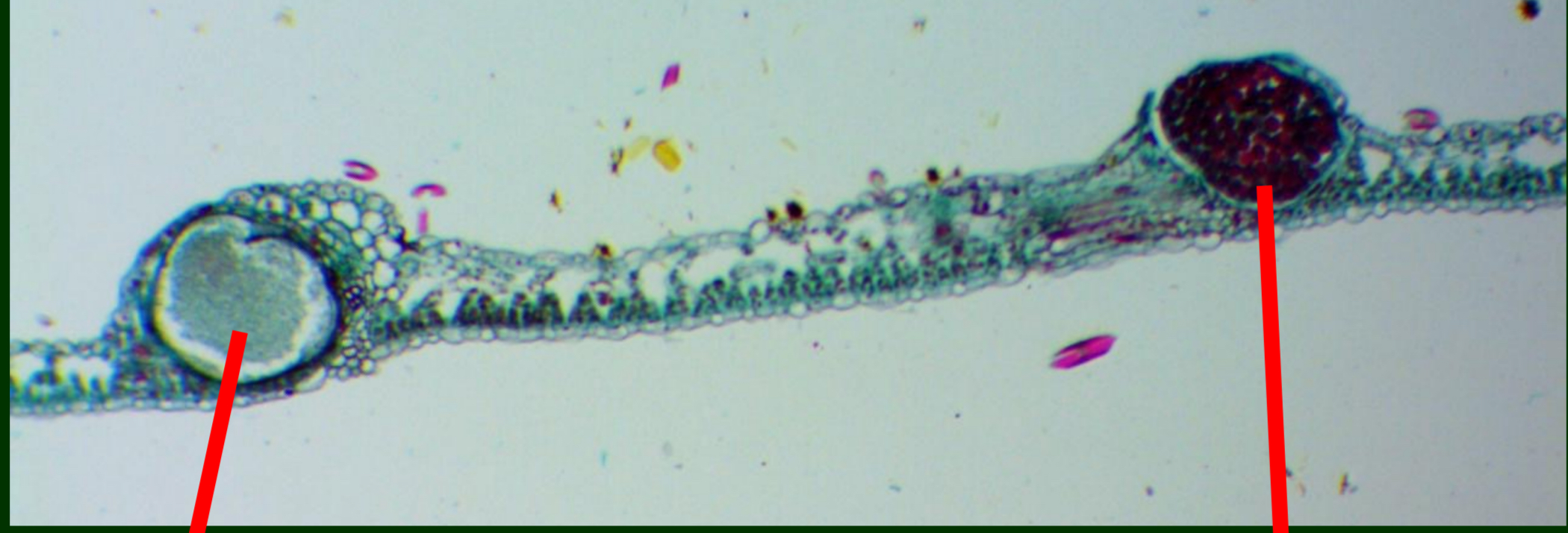 <p>What is seen in this ?&nbsp;</p>