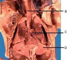 <p>What is structure A? What’s it function? </p>
