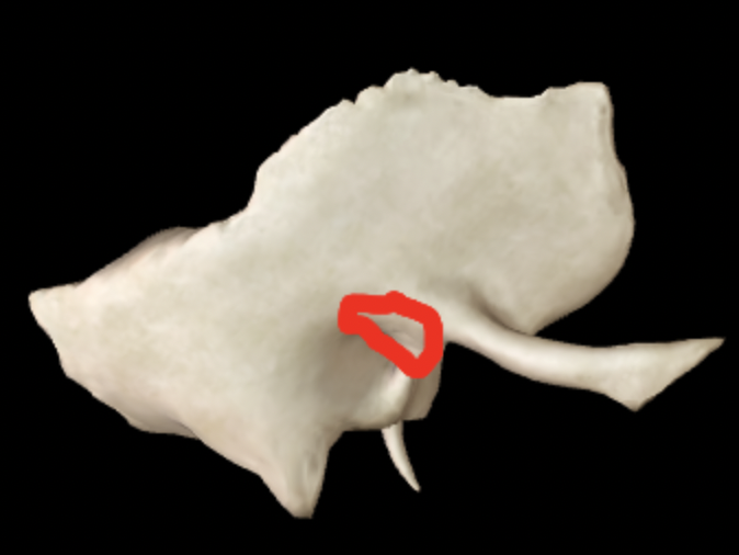 <p>What part of the temporal bone is this?</p>