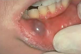 <p>diagnosis?</p>